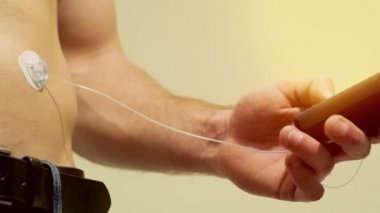 İnsülin pompası karnına bağlı ve elinde insülin pompası tutan diyabetik adam. Diyabet konsepti.