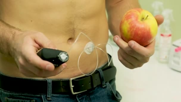 Homem Diabético Com Uma Bomba Insulina Conectada Abdômen Segurando Bomba — Vídeo de Stock