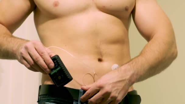 インスリンポンプを持つ糖尿病の男性は彼の腹部に接続され 彼の手でインスリンポンプを保持します 糖尿病コンセプト — ストック動画