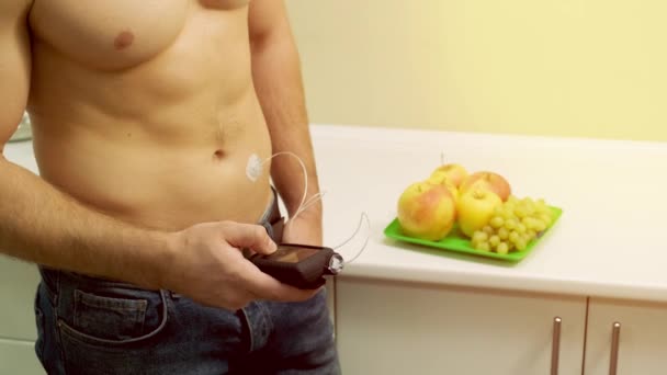 インスリンポンプを持つ糖尿病の男性は彼の腹部に接続され 彼の手でインスリンポンプを保持します 糖尿病コンセプト — ストック動画