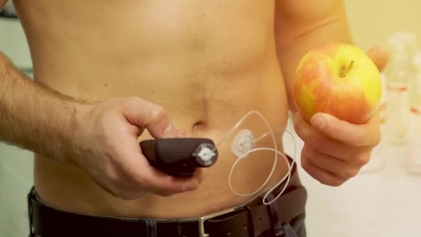 Pria Diabetik Dengan Pompa Insulin Terhubung Perutnya Dan Memegang Pompa — Stok Video