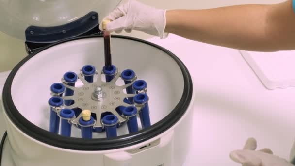 血小板リッチプラズマ調製 手に血液とチューブ 遠心分離機 — ストック動画