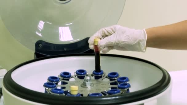 Bloedplaatjes Rijk Plasma Preparaat Buis Met Bloed Handen Centrifuge — Stockvideo