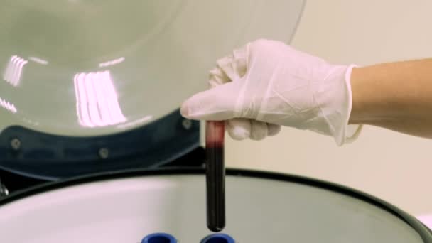 Preparação Plasma Rico Plaquetas Tubo Com Sangue Nas Mãos Centrifugadoras — Vídeo de Stock