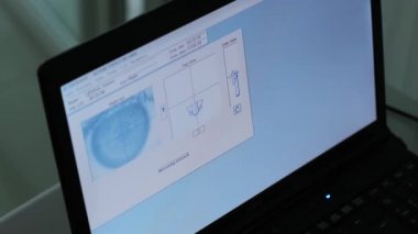 Ototimik cerrahi. Ameliyathanedeki tıbbi monitörden bakın. Lazer.