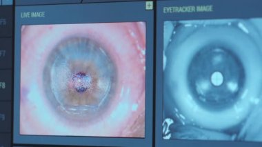 Ototimik cerrahi. Ameliyathanedeki tıbbi monitörden bakın. Lazer.