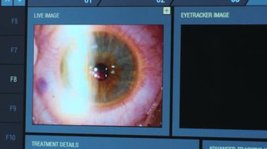 Ototimik cerrahi. Ameliyathanedeki tıbbi monitörden bakın. Lazer.