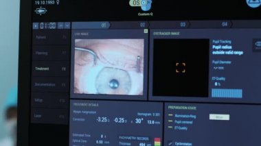 Ototimik cerrahi. Ameliyathanedeki tıbbi monitörden bakın. Lazer.