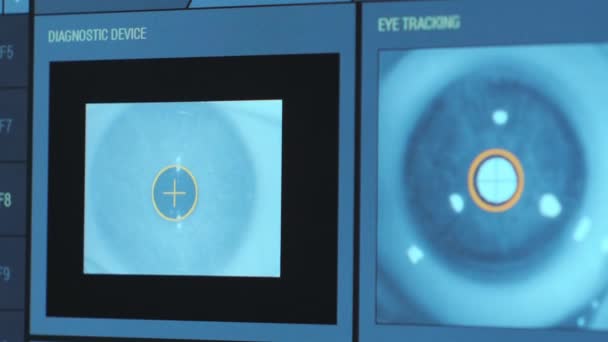 眼科手術です 手術室のモニターの画面で表示されます ラシック — ストック動画