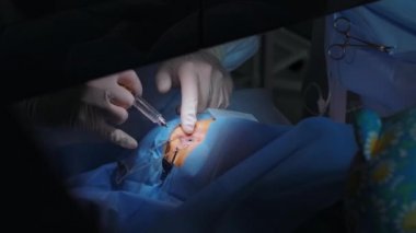 Lazer görüş düzeltmesi. Bir hasta ve bir cerrah ekibi göz ameliyatı sırasında ameliyathanede. Göz spekulumu. Lazer tedavisi. Hasta steril koruma altında.