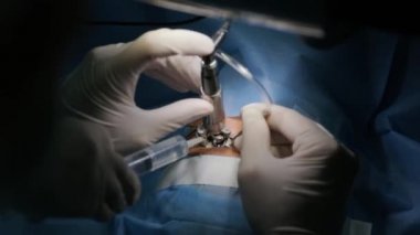 Lazer görüş düzeltmesi. Bir hasta ve bir cerrah ekibi göz ameliyatı sırasında ameliyathanede. Göz spekulumu. Lazer tedavisi. Hasta steril koruma altında.