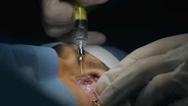 Laser Sehkorrektur Ein Patient Und Ein Chirurgenteam Operationssaal Während Der — Stockvideo