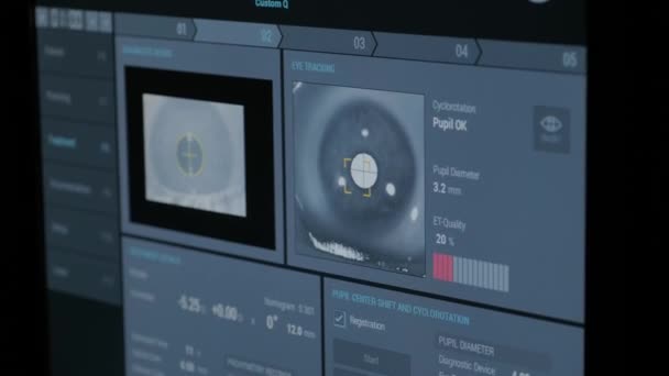 眼科手術です 手術室のモニターの画面で表示されます アイトラッキング — ストック動画