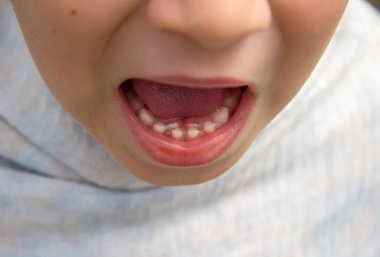 the child's root teeth, which grow next to the milk teeth. Teeth grow in two rows. These are the front teeth of the incisors, A child is european with bright skin. clipart