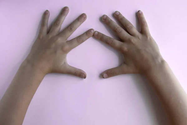 Dłonie przedszkolanki z brudnymi długimi paznokciami na różowym tle — Zdjęcie stockowe