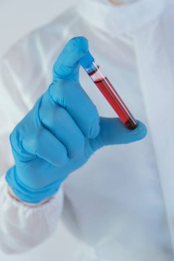 Virüsler için kan testi. Koruyucu giysili laboratuvar asistanı ve test tüpüyle maske.