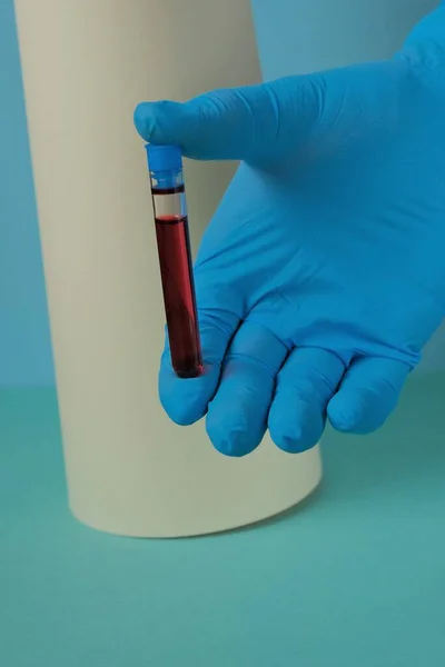 Análisis Sangre Para Detectar Virus Asistente Laboratorio Con Traje Protector —  Fotos de Stock