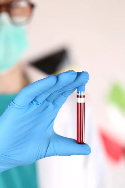 Coronavirus Epidemic Coronavirus Infection Blood Test Laboratory Flask Blood Hand — Stock Photo, Image