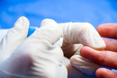 İnsülin testi, kan testi ve şırınga. Eline enjekte et. Hastalar ve doktor. Stüdyo çekimi.