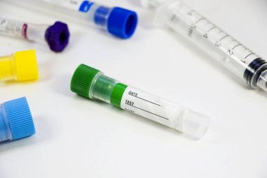 Beyaz arka planda kan testi boş tüp örnekleri, stüdyo çekimi. Renkli tüpler, isim, tarih ve test.
