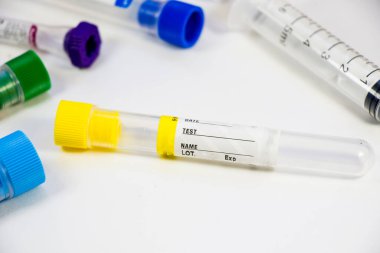 Beyaz arka planda kan testi boş tüp örnekleri, stüdyo çekimi. Renkli tüpler, isim, tarih ve test.