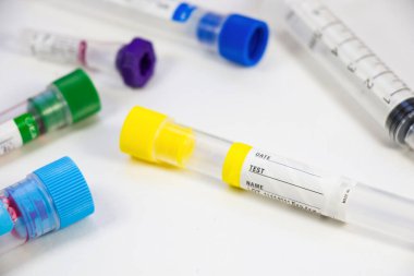 Beyaz arka planda kan testi boş tüp örnekleri, stüdyo çekimi. Renkli tüpler, isim, tarih ve test.