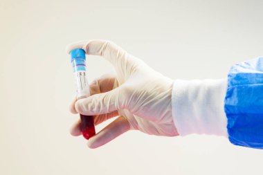 Doktorun elinde tam kan testi tüpleri, beyaz arka planda, stüdyo çekimlerinde..