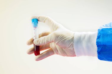 Doktorun elinde tam kan testi tüpleri, beyaz arka planda, stüdyo çekimlerinde..