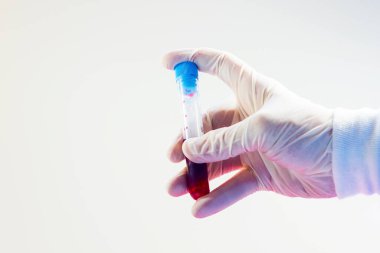 Doktorun elinde tam kan testi tüpleri, beyaz arka planda, stüdyo çekimlerinde..