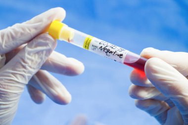 Beyaz arka planda Corona virüsü negatif kan test tüpleri, stüdyo çekimi. Kan testi örnekleri. Teşhis ve laboratuvar.