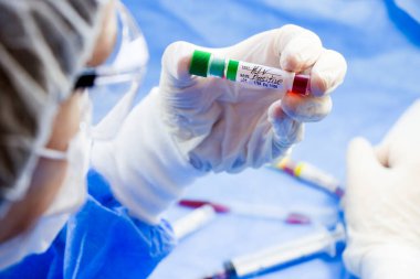 HIV ve AIDS enfeksiyon testi, doktorlar yüz ve el tüplerinde mavi arka planda kan var. Stüdyo çekimi.