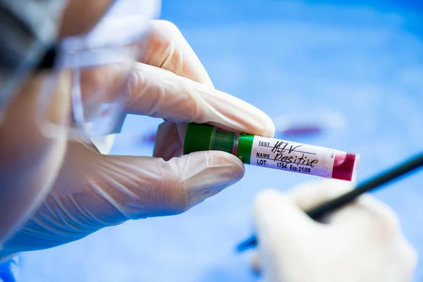 HIV ve AIDS enfeksiyon testi, doktorlar yüz ve el tüplerinde mavi arka planda kan var. Stüdyo çekimi.