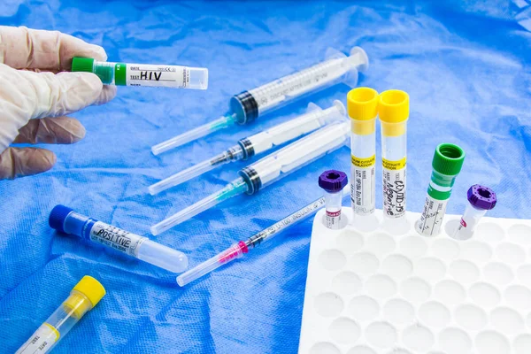 Hiv and aids infection test, doctors face and hand holding tube with blood on the blue background. Studio shoot.