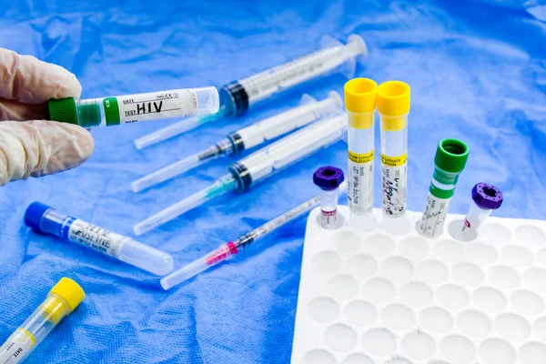 Hiv and aids infection test, doctors face and hand holding tube with blood on the blue background. Studio shoot.