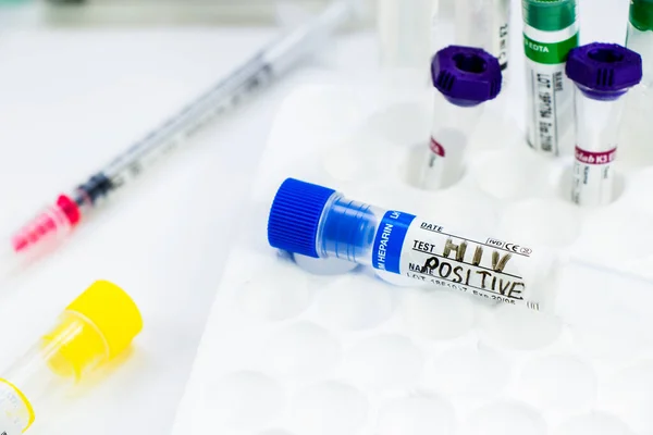HIV ve AIDS enfeksiyon testi, doktorlar yüz ve el tüplerinde mavi arka planda kan var. Stüdyo çekimi.