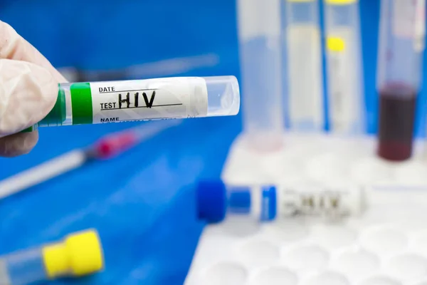 HIV ve AIDS enfeksiyon testi, doktorlar yüz ve el tüplerinde mavi arka planda kan var. Stüdyo çekimi.