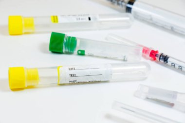 Beyaz arka planda kan testi boş tüp örnekleri, stüdyo çekimi. Renkli tüpler, isim, tarih ve test.
