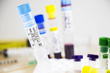 Beyaz arka planda Corona virüsü ve Covid-19 pozitif kan test tüpleri, stüdyo çekimi. Kan testi örnekleri. Teşhis ve laboratuvar.