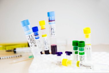 Beyaz arka planda Corona virüsü ve Covid-19 pozitif kan test tüpleri, stüdyo çekimi. Kan testi örnekleri. Teşhis ve laboratuvar.