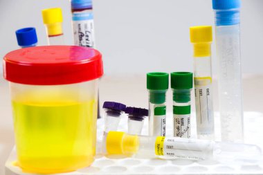 Uyuşturucu testi, tıbbi idrar testi ve beyaz arka planda kan ve diğer tüplerle yapılan idrar testi renkli laboratuvar test kapları, virüsler ve doping laboratuvar testleri. Covid 19, HIV, AIDS ve diğer enfeksiyonlar