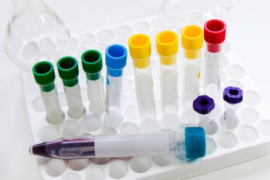 Laboratuvar kan testi tüpü örnekleri, araştırma teşhisleri steril tablo stüdyosundaki aletler ve objeler..