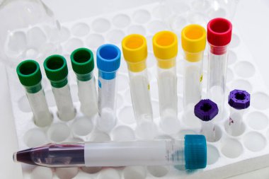 Laboratuvar kan testi tüpü örnekleri, araştırma teşhisleri steril tablo stüdyosundaki aletler ve objeler..