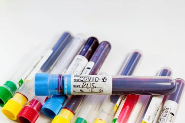 Beyaz arka planda Corona virüsü ve Covid-19 pozitif kan test tüpleri, stüdyo çekimi. Kan testi örnekleri. Teşhis ve laboratuvar.