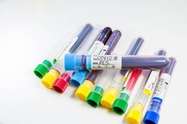 Beyaz arka planda Corona virüsü ve Covid-19 pozitif kan test tüpleri, stüdyo çekimi. Kan testi örnekleri. Teşhis ve laboratuvar.