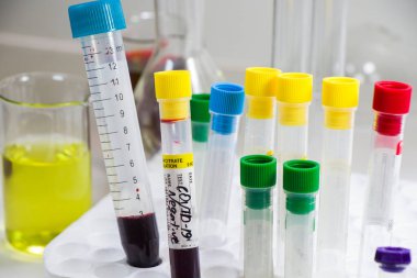 Beyaz arka planda Corona virüsü ve Covid-19 pozitif kan test tüpleri, stüdyo çekimi. Kan testi örnekleri. Teşhis ve laboratuvar. Kimyasal elementler.