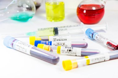 H1N1, Covid-19, Hepatit C, Tüberküloz ve Staphylococcus virüsleri tüplerdeki kan testleri, laboratuvar teşhisleri, metinler ve mektuplar.