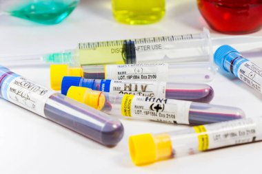 H1N1, Covid-19, Hepatit C, Tüberküloz ve Staphylococcus virüsleri tüplerdeki kan testleri, laboratuvar teşhisleri, metinler ve mektuplar.