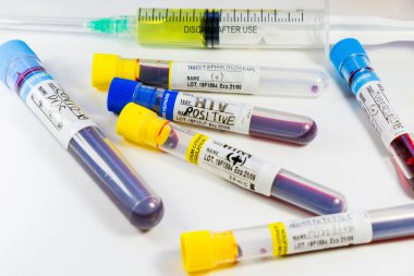 H1N1, Covid-19, Hepatit C, Tüberküloz ve Staphylococcus virüsleri tüplerdeki kan testleri, laboratuvar teşhisleri, metinler ve mektuplar.