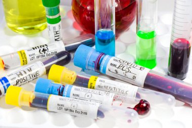 H1N1, Covid-19, Hepatit C, Tüberküloz ve Staphylococcus virüsleri tüplerdeki kan testleri, laboratuvar teşhisleri, metinler ve mektuplar.