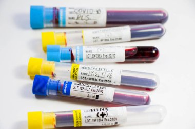 H1N1, Covid-19, Hepatit C, Tüberküloz ve Staphylococcus virüsleri tüplerdeki kan testleri, laboratuvar teşhisleri, metinler ve mektuplar.